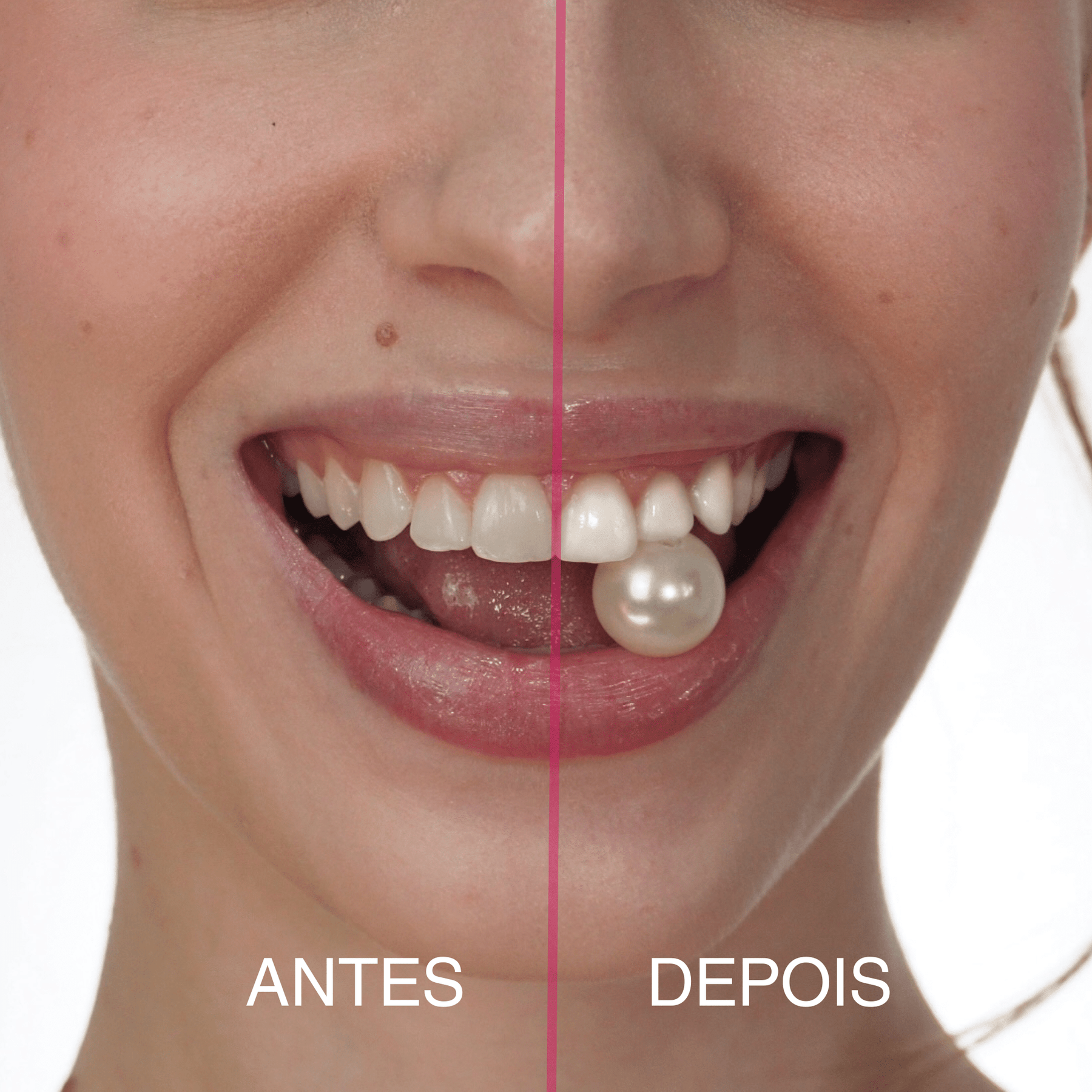 Fita Clareadora PAP+ Smilie